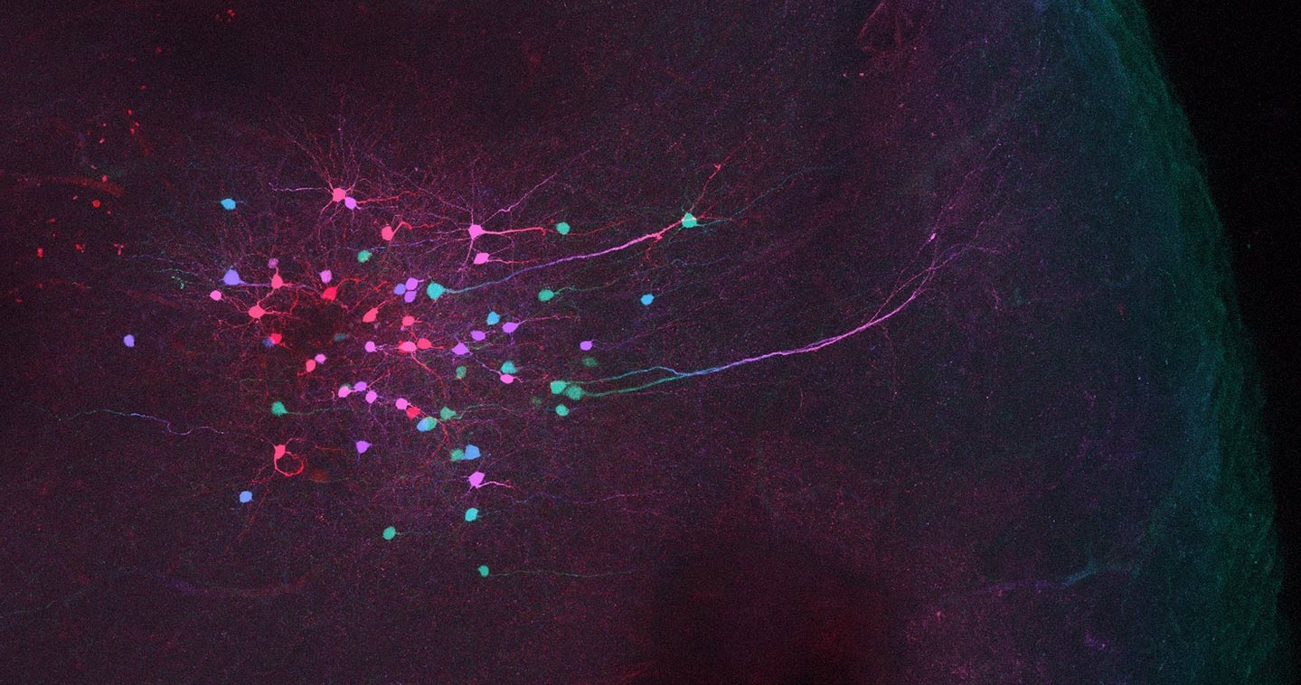 world-wide-neuro